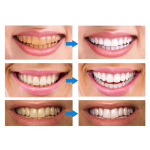 Stylo de Nettoyage et de Blanchiment des Dents