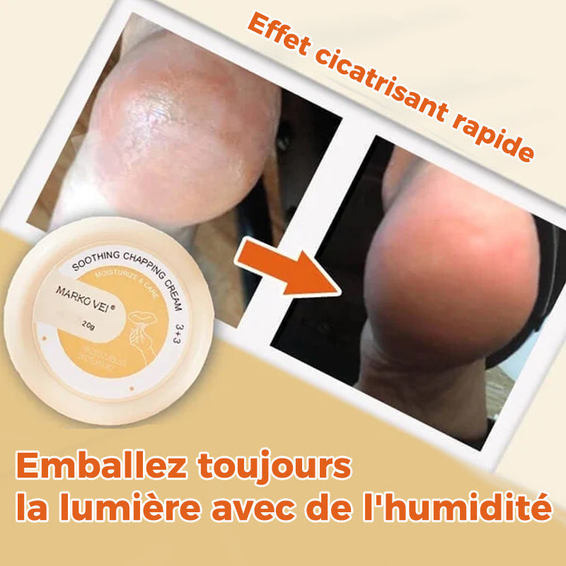 Crème anti-déchirure pour peau d'hiver
